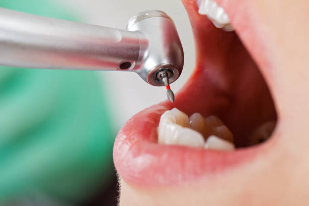 Best Same-Day Emergency Dental Services in Burke Centre, VA